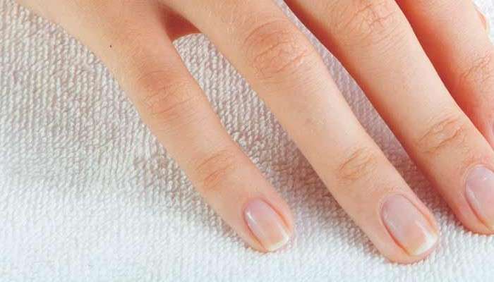 White Spots On Nails: আপনার নখে কি সাদা দাগ আছে? অবিলম্বে সাবধান হন! 