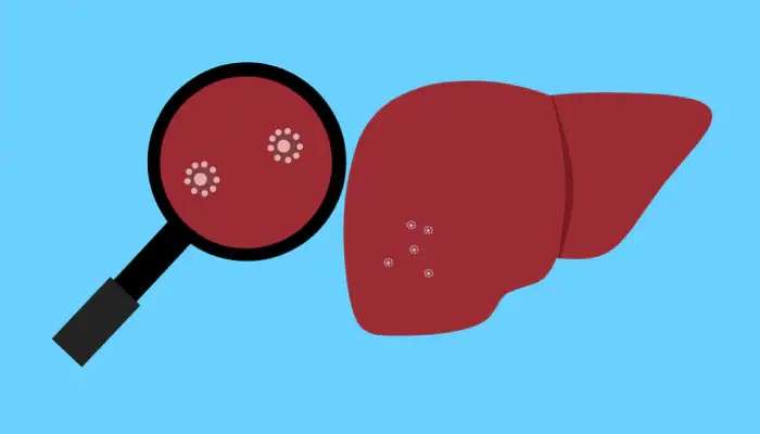 Kids At Risk: Acute Hepatitis-এ আক্রান্ত লিভার! অজানা রোগের কবলে ১২ দেশ 