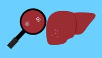  Acute Hepatitis-এ আক্রান্ত লিভার! অজানা রোগের কবলে ১২ দেশ 