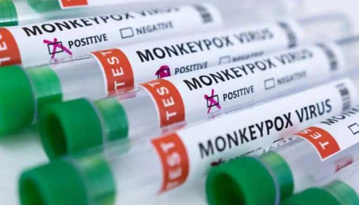 Monkeypox In India: মাঙ্কিপক্স আতঙ্ক ভারতে, পরীক্ষায় গাজিয়াবাদের নাবালিকার নমুনা