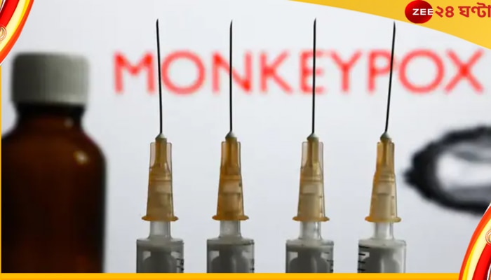 Monkeypox Cases: অনিয়ন্ত্রিত যৌনাচারে ছড়াচ্ছে ৯৫% মাঙ্কিপক্স, নয়া গবেষণা রিপোর্টে আতঙ্ক! 