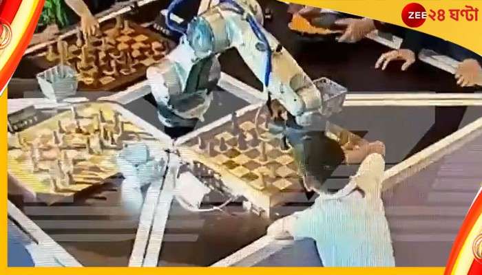Robot Breaks Finger: দাবা খেলতে খেলতে সাত বছরের শিশুর আঙুল ভেঙে দিল রোবট!