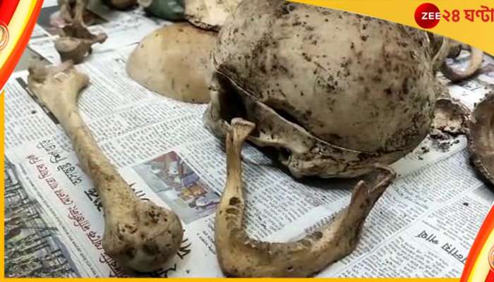 Siliguri skeleton: আর্বজনার স্তুপে বস্তাবন্দি খুলি, হাড়গোড়! আতঙ্ক শিলিগুড়িতে