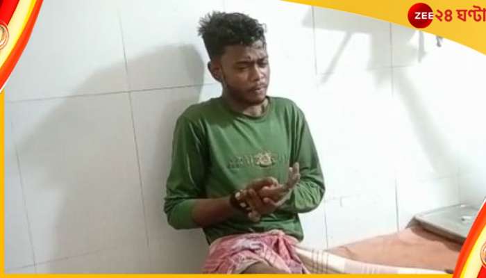 Mobile Blast: পকেটে রাখা মোবাইলে বিস্ফোরণ! হাওড়ায় গুরুতর জখম যুবক