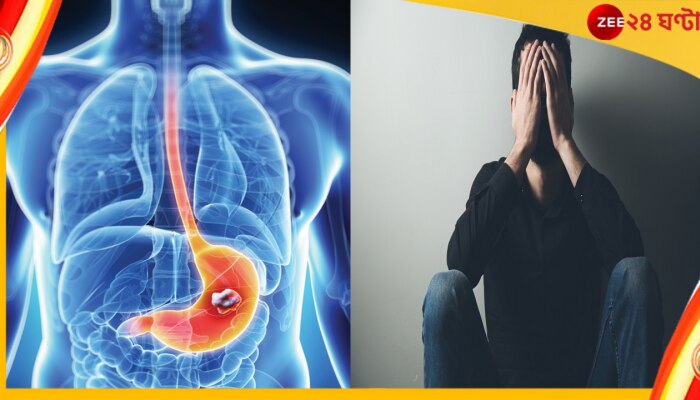 stomach Cancer: এখনও সিঙ্গল? ক্যানসারে মৃত্যুর সম্ভাবনা কিন্তু আপনার বেশি!
