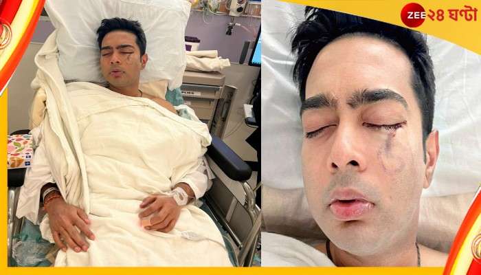 Abhishek Banerjee: জটিল অস্ত্রোপচার সফল, দীপাবলির আগেই দেশে ফিরছেন অভিষেক