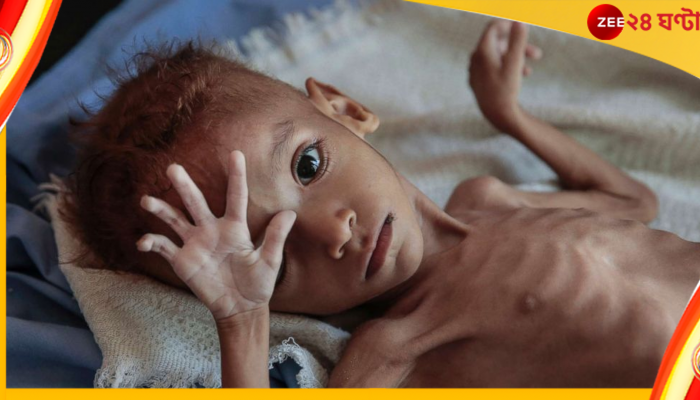 Hunger : খাচ্ছেন কিন্তু ভাবছেন কি? ১ মিনিটে না-খেয়ে মরছে ১১ জন! 