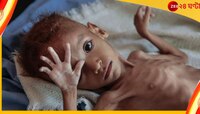 Hunger : খাচ্ছেন কিন্তু ভাবছেন কি? ১ মিনিটে না-খেয়ে মরছে ১১ জন! 