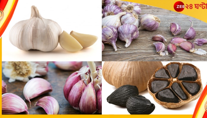Garlic: রসুন আদতে চার ধরনের, কোনটি স্বাস্থ্যের জন্য ভালো জানেন? 