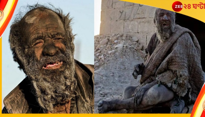 World Dirtiest Man: ৭০ বছর গায়ে ছোঁয়াননি জল, স্নানের পরই মারা গেলেন বিশ্বের ‘নোংরাতম’ মানুষ! 