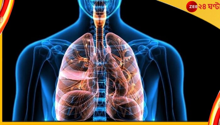 COPD: সিওপিডি সম্পর্কে আপনারও এই সব ভুল ধারণা আছে নাকি?