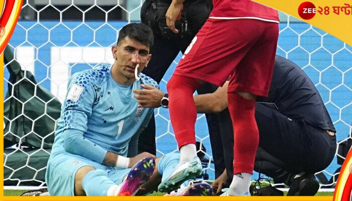 FIFA World Cup 2022, ENG vs IRAN: মাথা ফেটে রক্তাক্ত গোলকিপার বেইরানভান্দ, ১৪ মিনিট বন্ধ ম্যাচ FIFA World Cup 2022, ENG vs IRAN: মাথা ফেটে রক্তাক্ত গোলকিপার বেইরানভান্দ, ১৪ মিনিট বন্ধ ম্যাচ