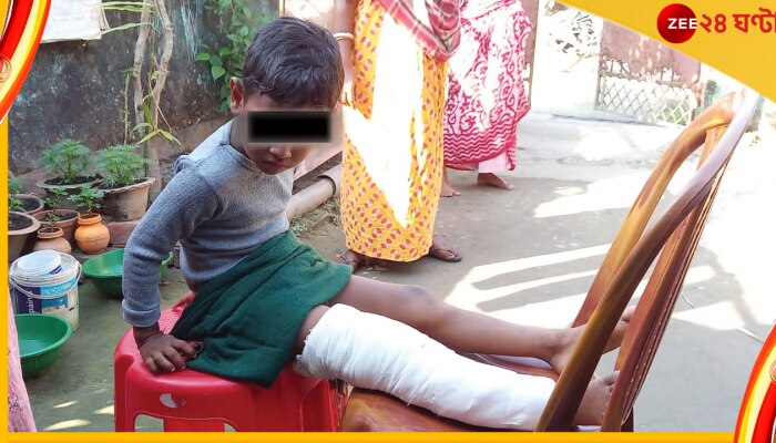 Jalpaiguri: বানান ভুল করায় শিশুকে লাঠিপেটা, শিক্ষিকার মারে ভাঙল একরত্তির পা Jalpaiguri: বানান ভুল করায় শিশুকে লাঠিপেটা, শিক্ষিকার মারে ভাঙল একরত্তির পা