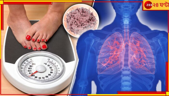 Health Awareness: আচমকাই কমে যাচ্ছে ওজন? কোনও টিউমারের কারণে নয় তো! Health Awareness: আচমকাই কমে যাচ্ছে ওজন? কোনও টিউমারের কারণে নয় তো!