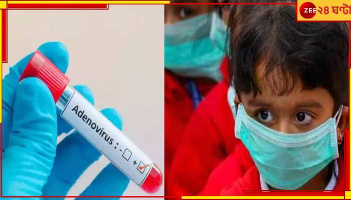 Adeno Virus: অ্যাডিনোর দাপট বাড়ছে, ভাইরাস হানায় আরও ২ শিশুর মৃত্যু 