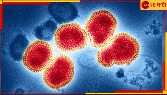 H3N2 Virus: ফের মৃত্যু! দেশ জুড়ে সকলের রাতের ঘুম কেড়ে নিচ্ছে নতুন মারণ ভাইরাস H3N2...
