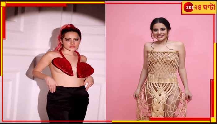 Uorfi Javed: এ কী হল উর্ফির! ছবি দেখে হতবাক নেটপাড়া