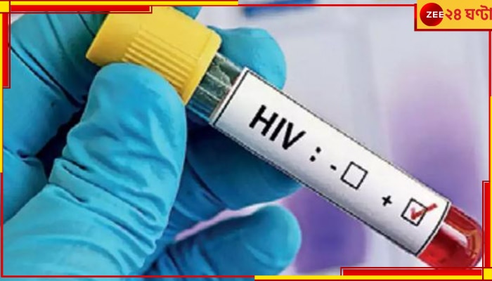 Kalyani JNM Hospital: সরকারি হাসপাতালে ডায়ালিসিস করাতে গিয়ে AIDS আক্রান্ত ৬!