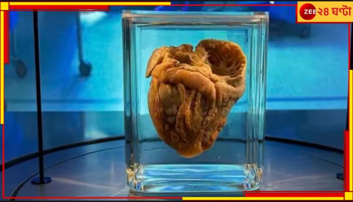 Heart Transplant: মিউজিয়াম ঘুরতে গিয়ে ১৬ বছর পরে নিজের হৃৎপিণ্ড দেখলেন মহিলা...