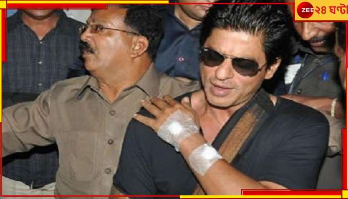 Shah Rukh Khan injured: নাকে গুরুতর চোট! শ্যুটিং চলাকালীন আহত শাহরুখের অস্ত্রোপচার