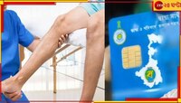 অর্থোপেডিক সার্জারি নিয়ে কড়াকড়ি! স্বাস্থ্যসাথীতে খরচ কমাতে মরিয়া রাজ্য