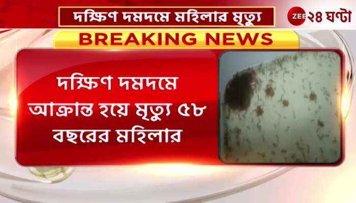 Woman died because of dengue in South Dumdum