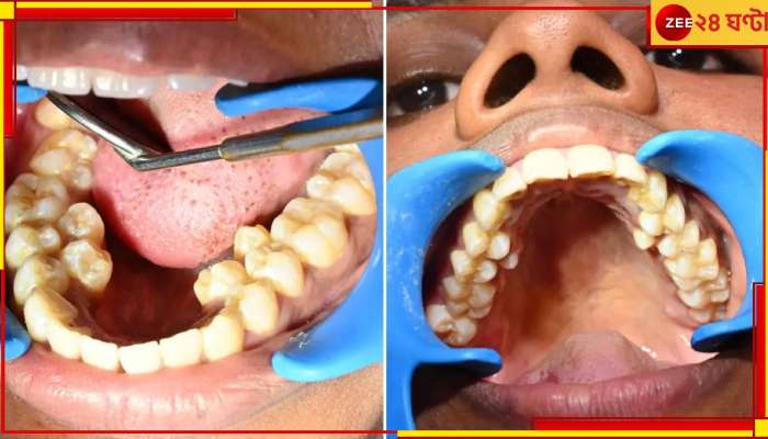 Indian Woman with Highest Teeth sets Guinness Record: মুখে দাঁতের বাজার বসিয়ে গিনেস বুকে নাম তুললেন ভারতের কল্পনা!