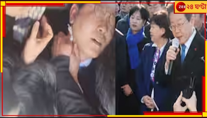 South Korea: দেশের বিরোধী নেতার গলায় ছুরি! ঘরে-বাইরে প্রবল চাপে রাষ্ট্রপতি 
