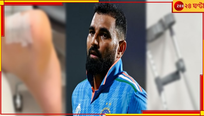 Mohammed Shami Injury Update: গোড়ালিতে সার্জিকাল টেপ, বিছানার পাশে ক্রাচ! বিষণ্ণ মুখে শামি জানালেন... 