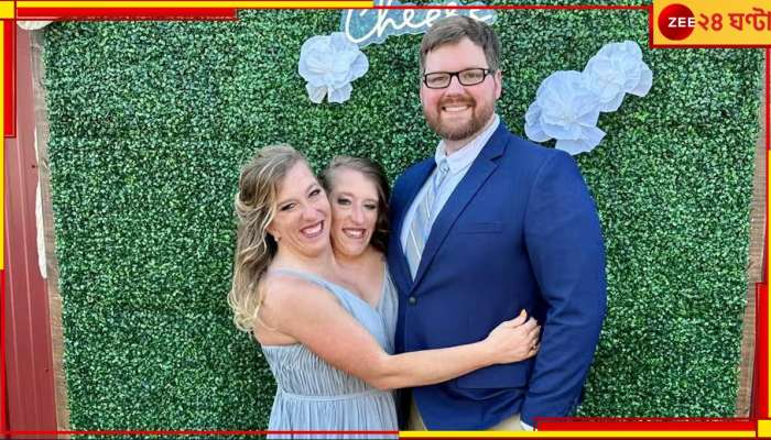 Conjoined twin Abby Hensel Wedding: অভিন্ন শরীরে ভিন্ন হৃদয়! এক প্রাক্তন সেনাকেই বিয়ে করলেন যমজ বোন...