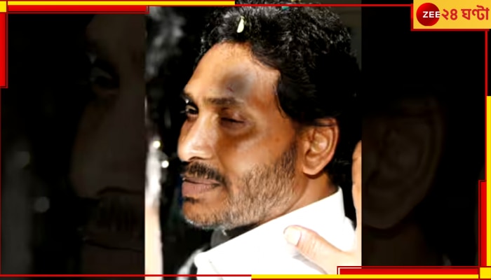 Jagan Mohan Reddy Injured: প্রচারে উড়ে এল ইট-পাটকেল, আহত মুখ্যমন্ত্রী!