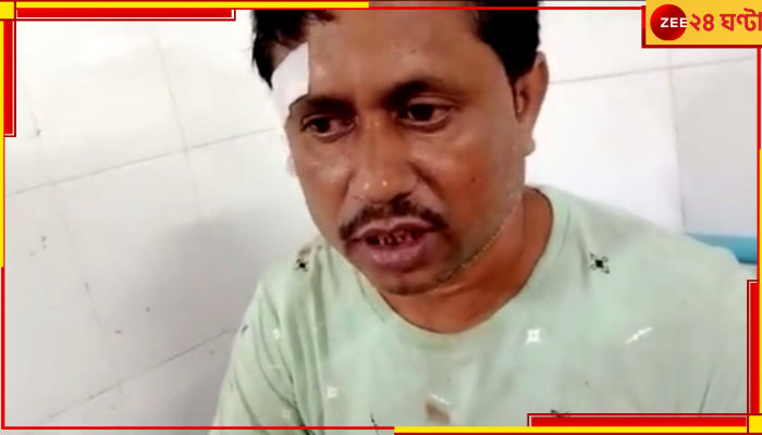 BJP Worker Attacked:  তৃণমূল ছেড়ে বিজেপি যোগদানের 'অপরাধে' বেধড়ক মার, করা হল এই নক্কারজনক কাজ
