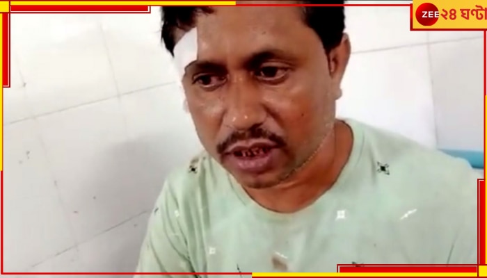 BJP Worker Attacked: তৃণমূল ছেড়ে বিজেপি যোগদানের &#039;অপরাধে&#039; বেধড়ক মার, কেটে নেওয়া হল কান