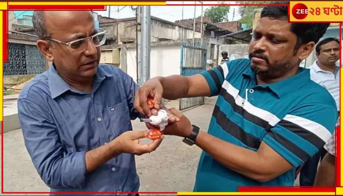 Ranigunj: ক্লাস নেওয়া নিয়ে গন্ডগোল, শিক্ষকের মারের চোটে ভাঙল প্রধান শিক্ষকের হাতের আঙুল!