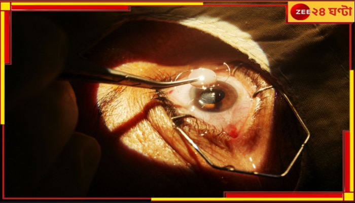Cataract Operation: হাসপাতালে ছানি অপারেশন করিয়ে অন্ধ? খাস কলকাতায় ভয়ংকর অভিযোগ 