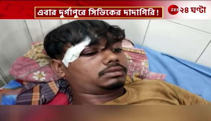 Argument in Durgapur complaint of beating against the civic police