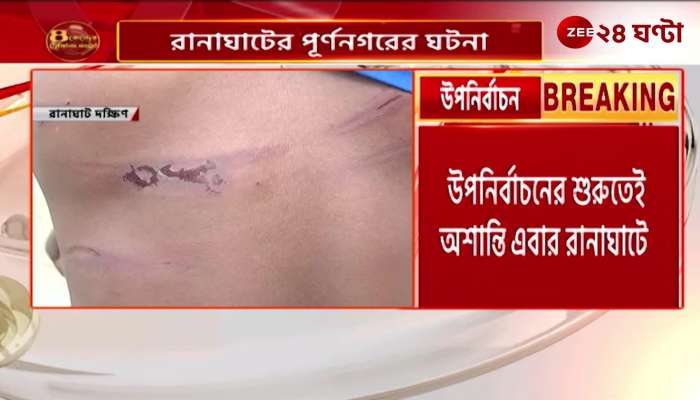 BJPs gram panchayat member beaten