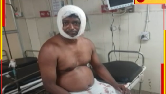 Attack on Police: টহলদারির সময়ে হামলা! খাস কলকাতায় আক্রান্ত পুলিস, গ্রেফতার অভিযুক্ত....