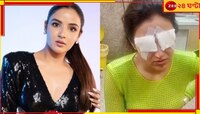 লেন্স পরতেই চোখে ব্যথা, দৃষ্টিশক্তি হারাতে বসেছেন জনপ্রিয় অভিনেত্রী জেসমিন!