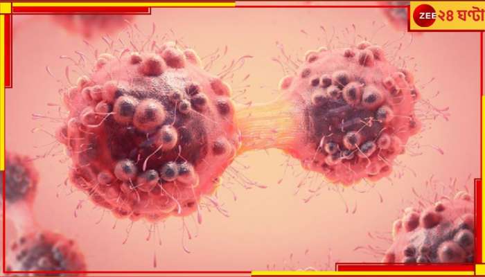Cancer: মহা 'মৃত্যুফাঁদে' তরুণ প্রজন্ম! বাড়ছে ১৭ ক্যানসারের ঝুঁকি, বাড়ছে মৃত্যুহার... Cancer: মহা 'মৃত্যুফাঁদে' তরুণ প্রজন্ম! বাড়ছে ১৭ ক্যানসারের ঝুঁকি, বাড়ছে মৃত্যুহার...