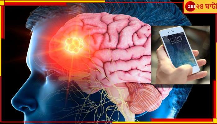 Mobile phone | Brain Cancer: মোবাইল ফোন ডেকে আনছে ব্রেইন ক্যানসার? আসল সত্যিটা জানুন...