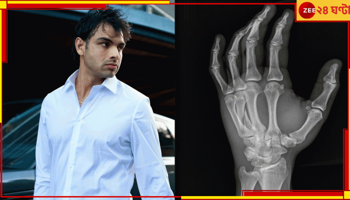 Neeraj Chopra: এক্স-রে দেখে আঁতকে উঠল সবাই! বর্শা তুলে রাখছেন 'সোনার ছেলে'? তোলপাড় নেটপাড়া...