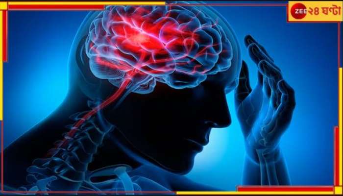 World Stroke Day: স্ট্রোক হলেও বাঁচতে পারে প্রাণ! কিন্তু কীভাবে ? জানতে পড়ুন... World Stroke Day: স্ট্রোক হলেও বাঁচতে পারে প্রাণ! কিন্তু কীভাবে ? জানতে পড়ুন...