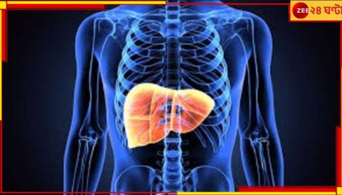 Liver Cancer: বহুদিন সুরাসক্ত! আপনি কি লিভার ক্যানসারে আক্রান্ত হতে পারেন?