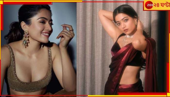 Rashmika Mandanna: গুরুতর চোট পেয়েছেন রশ্মিকা! কেমন আছেন ন্যাশানাল ক্রাশ?