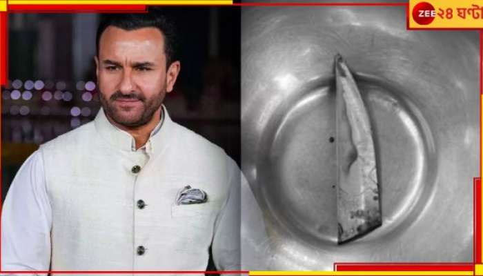 Saif Ali Khan Stabbed: বরাত জোরে বাঁচলেন সইফ, &#039;ছুরিটা আর একটু গভীরে গেলেই...!&#039;