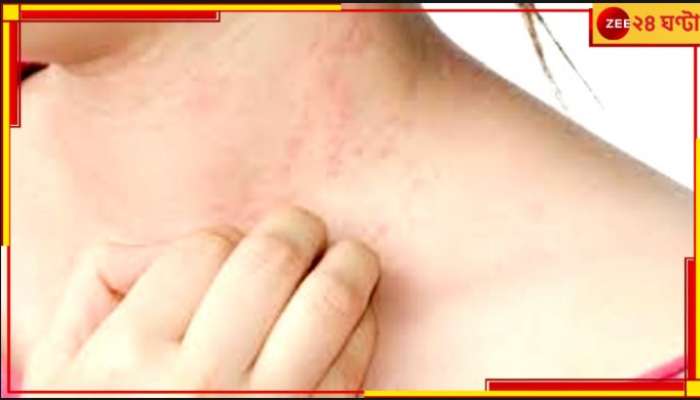 Red Spot in Skin: আচমকাই ত্বকে দেখা দিচ্ছে বিশ্রী লাল দাগ, জেনে নিন কিসের ঘাটটিতে হয় এসব...