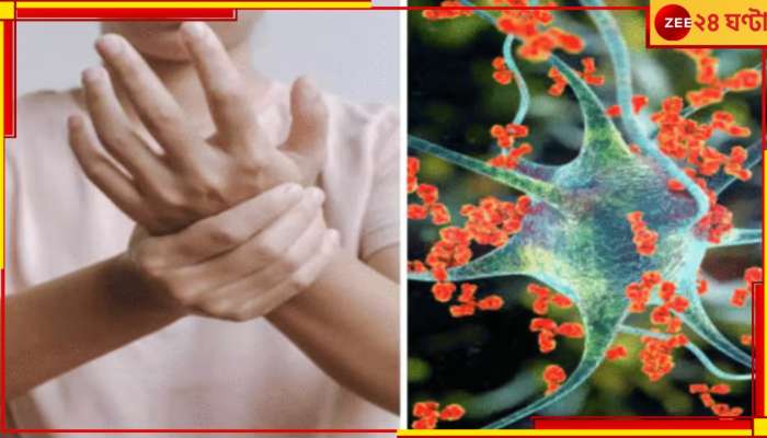 Gullain Barre Syndrome Update: রোগীর শরীরে মিলল...কোন ব্যাকটেরিয়া-ভাইরাসের সংক্রমণে ছড়াচ্ছে গিয়ান বার?