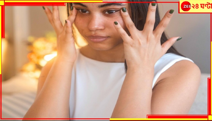 Dark Circles: 'ডার্ক সার্কল'কে ছোট করে দেখছেন? আপনি কিন্তু অজান্তেই ভয়ংকর রোগের কবলে পড়েছেন... Dark Circles: 'ডার্ক সার্কল'কে ছোট করে দেখছেন? আপনি কিন্তু অজান্তেই ভয়ংকর রোগের কবলে পড়েছেন...