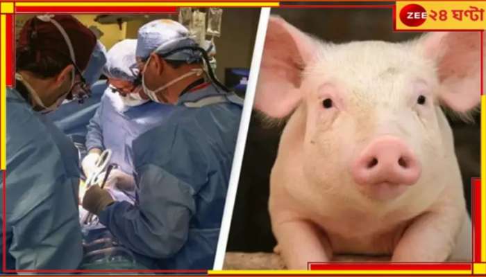 Pig Kidney Transplants in Humans: ডায়ালিসিস নিতে নিতেই মরতে হবে না আর! এবার মানুষের শরীরে কাজ করবে শুয়োরের কিডনি... Pig Kidney Transplants in Humans: ডায়ালিসিস নিতে নিতেই মরতে হবে না আর! এবার মানুষের শরীরে কাজ করবে শুয়োরের কিডনি...